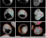 Tomocube holotomography microscopy reveals novel cholesterol membrane transport system in erythrocytes infected with fatal malaria parasite