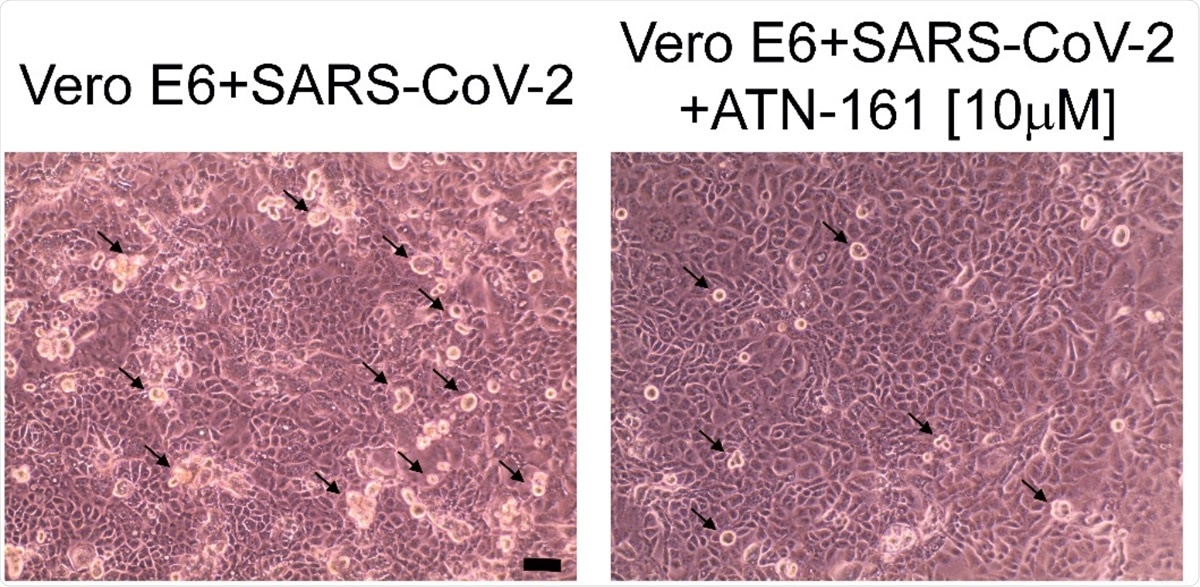Representative phase contrast microscope images of VeroE6 cells 24 hours post-infection with and without 10 µM ATN-161 treatment. Black arrows indicate some of the visible viral cytopathic effect (rounded, phase bright cells). Scale bar is 10 µM. Data represent mean ± SD,