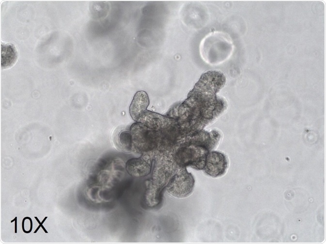 Organoids exhibit similar spatial organization and function to the represented organ, as exemplified by the crypt/villus morphology of this small intestinal organoid.