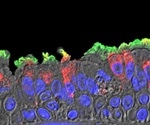Scientists map how SARS-CoV-2 infects the airways