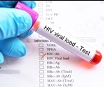 What is Viral Load?