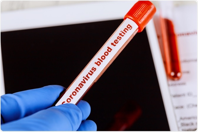 Coronavirus Blood Test
