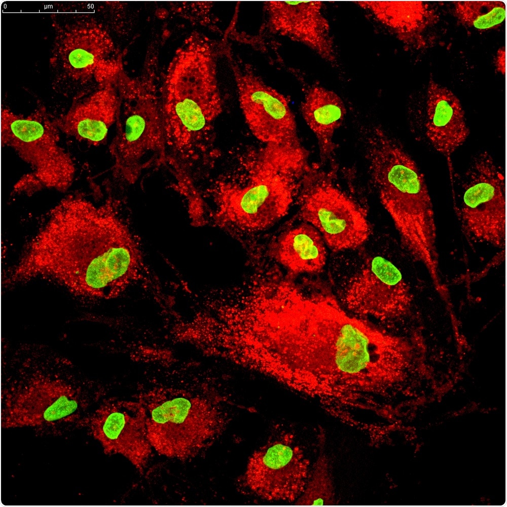 Mesenchymal stem cells labeled with fluorescence molecules. Image Credit: Vshivkova / Shutterstock
