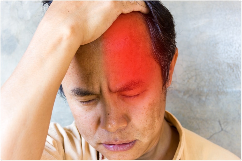 Study: Perceptions, experiences, and understandings of cluster headache among GPs and neurologists: a qualitative study. Image Credit: GUNDAM_Ai / Shutterstock