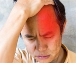 Excruciating cluster headaches often misdiagnosed