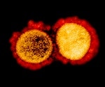 Antimalarial drug shows in vitro activity against SARS-CoV-2 and flu viruses