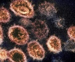 Mutated European strain of coronavirus more contagious but less potent