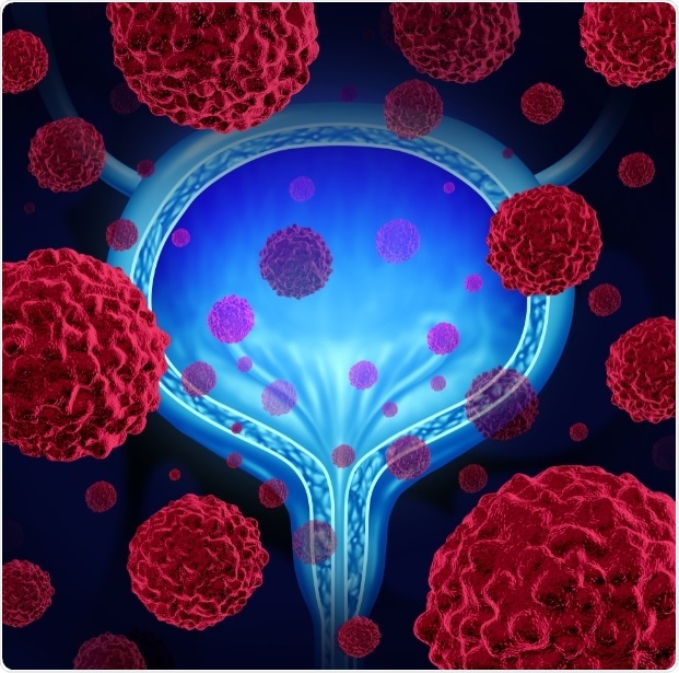 New scanner to detect early signs of bladder cancer could save thousands of lives