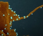 Scientists find coronavirus' Achilles' heel