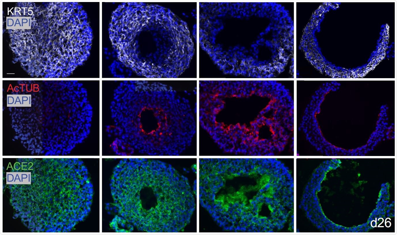 Basal organoids from mixed distal lung culture