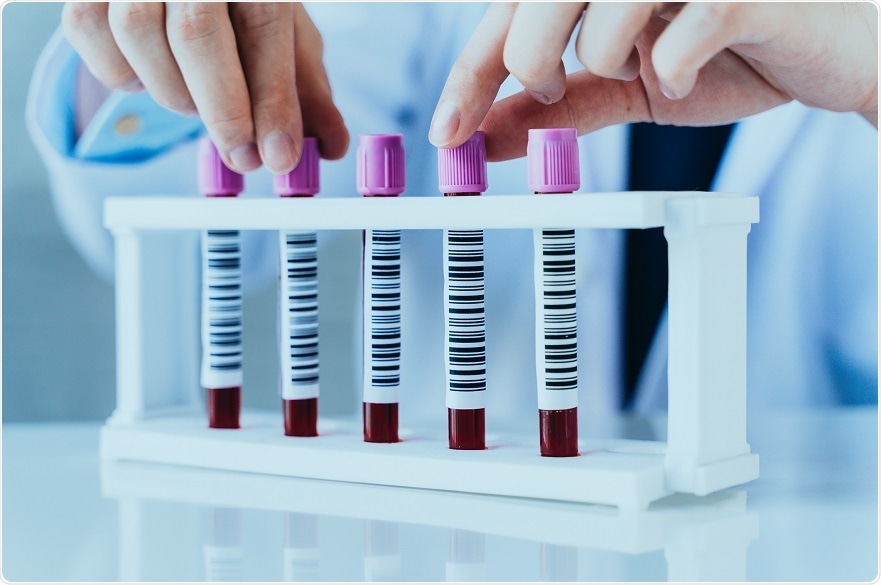 New blood test can detect prostate cancer and confirm the stage of the disease