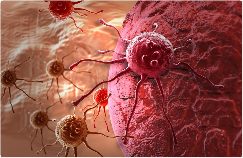 New cancer imaging system hastens cancer detection
