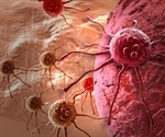 New cancer imaging system hastens cancer detection