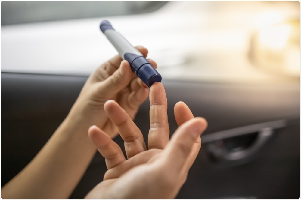 Study: Fasting blood glucose at admission is an independent predictor for 28-day mortality in patients with COVID-19 without previous diagnosis of diabetes: a multi-centre retrospective study. Image Credit: Montri Thipsorn / Shutterstock