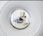 Novel CT scan method reduces radiation exposure