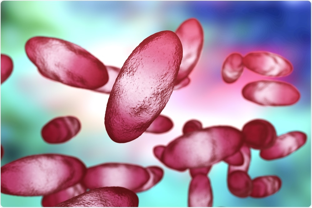 Bubonic plague bacteria Yersinia pestis.  Image Credit: Kateryna Kon / Shutterstock