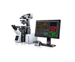 Olympus scanR high-content screening station v. 3.2 brings improved image quality with award-winning X Line objectives