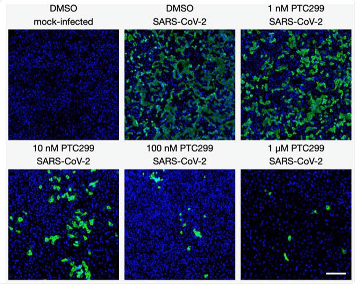 PTC299 inhibits SARS-CoV-2 replication. Quantitative immunofluorescence analysis of SARS-CoV-2-infected Vero E6 cells treated with PTC299. PTC299 was added at concentrations ranging from 1 nM to 1 μM 30 minutes prior to infection of Vero E6 cells with SARS-CoV-2 (USA-WA1/2020) at a multiplicity of infection (MOI) of 0.1. At 48 hours post-infection, the cells were fixed, probed with antibodies against the nucleocapsid protein (NP) of SARS-CoV-2 and stained with AlexaFluor 488 conjugated secondary antibody. Nuclei were stained with DAPI. Images acquired in the Green (i.e., NP of SARSCoV- 2) and the Blue (DAPI) channels were overlaid and are displayed as indicated (note images corresponding to the 3 nM concentration of PTC299 were omitted for simplicity). Scale bar, 200 μm.