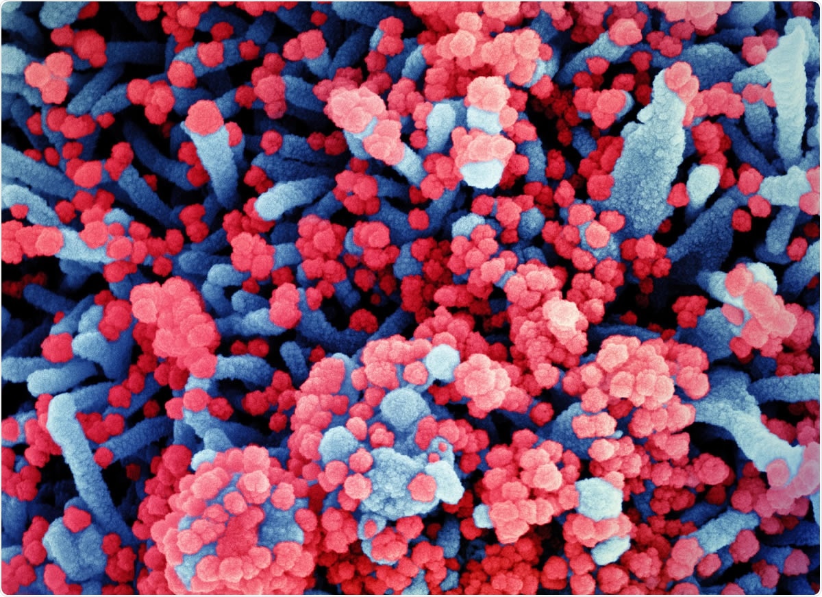 Colorized scanning electron micrograph of a cell (blue) heavily infected with SARS-CoV-2 virus particles (red), isolated from a patient sample. Image captured at the NIAID Integrated Research Facility (IRF) in Fort Detrick, Maryland. Credit: NIAID