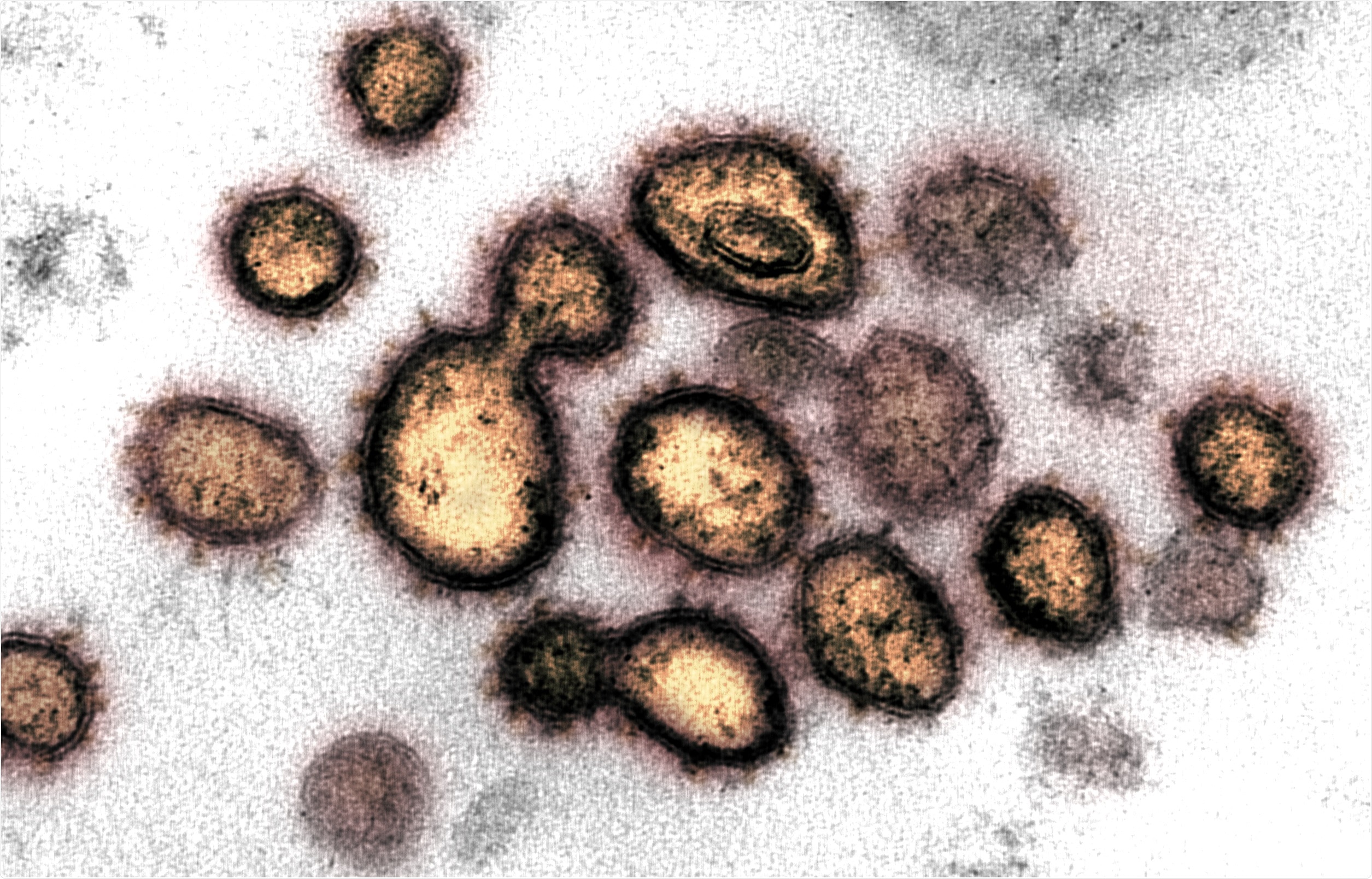 This transmission electron microscope image shows SARS-CoV-2, the virus that causes COVID-19, isolated from a patient in the U.S. Virus particles are shown emerging from the surface of cells cultured in the lab. The spikes on the outer edge of the virus particles give coronaviruses their name, crown-like. Image captured and colorized at NIAID