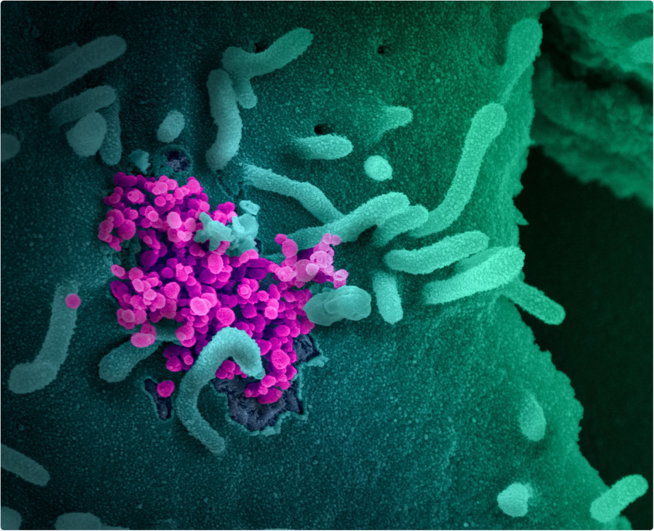 This scanning electron microscope image shows SARS-CoV-2 (round magenta objects) emerging from the surface of cells cultured in the lab. SARS-CoV-2, also known as 2019-nCoV, is the virus that causes COVID-19. The virus shown was isolated from a patient in the U.S. Image captured and colorized at NIAID