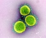 Pre-COVID-19 coronavirus immunity does not protect against SARS-CoV-2