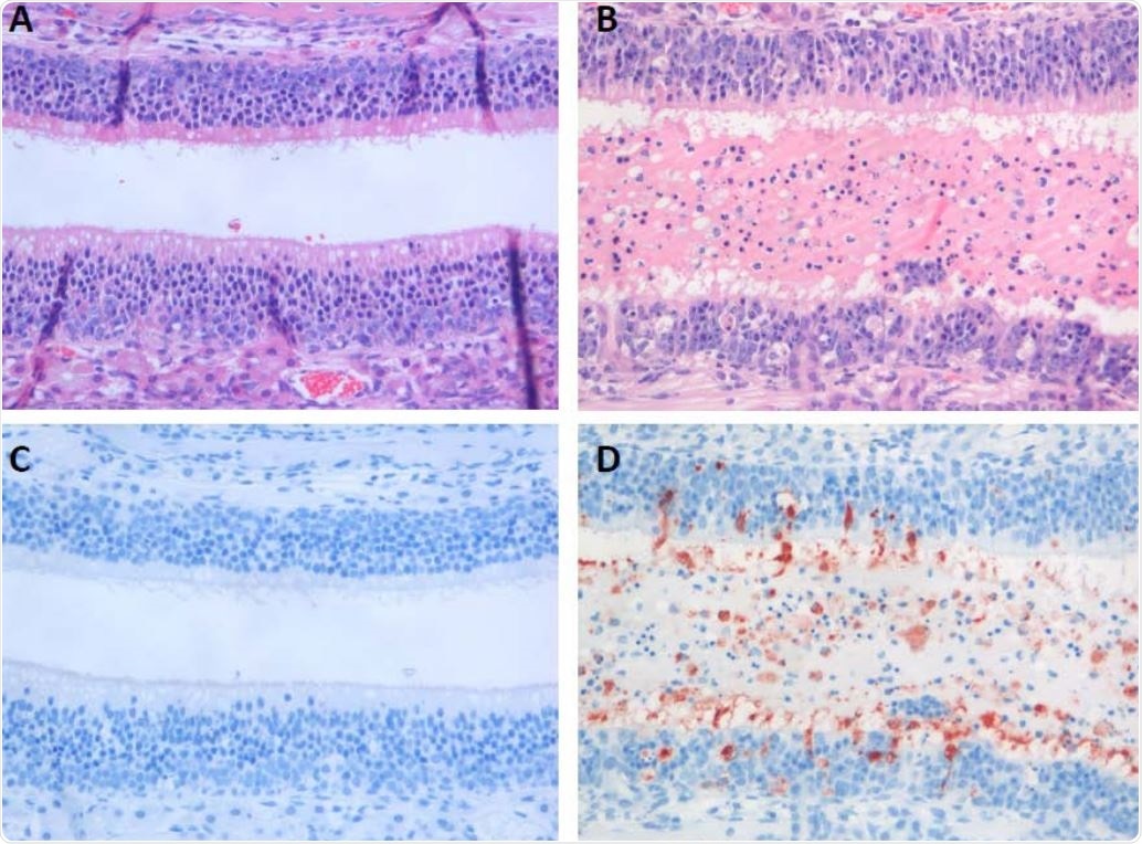 Histopathological changes and virus antigen expression in nasal turbinates of hamsters after challenge with SARS-CoV-2. In the nasal turbinate of a sham-inoculated hamster (left column), the nasal cavity is empty and the histology of the olfactory mucosa is normal (A). In a 511 serial section, there is no SARS-CoV-2 antigen expression (C). In the nasal turbinate of a non512 treated SARS-CoV-2-inoculated hamster (B and D), nasal cavity is filled with edema fluid mixed with inflammatory cells and debris and the olfactory mucosa is infiltrated by neutrophils (B). A serial section of this tissue shows SARS-CoV-2 antigen expression in many olfactory mucosal cells, as well as in cells in the lumen (C).