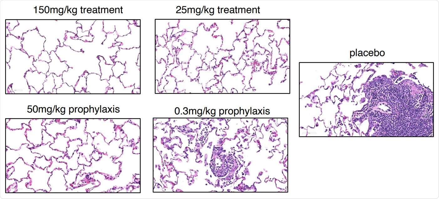Prophylactic and therapeutic efficacy of REGN-COV2 in the rhesus macaque model of SARSCoV-2 infection (NHP Study #2). Representative images of histopathology in lungs of treated and placebo animals.