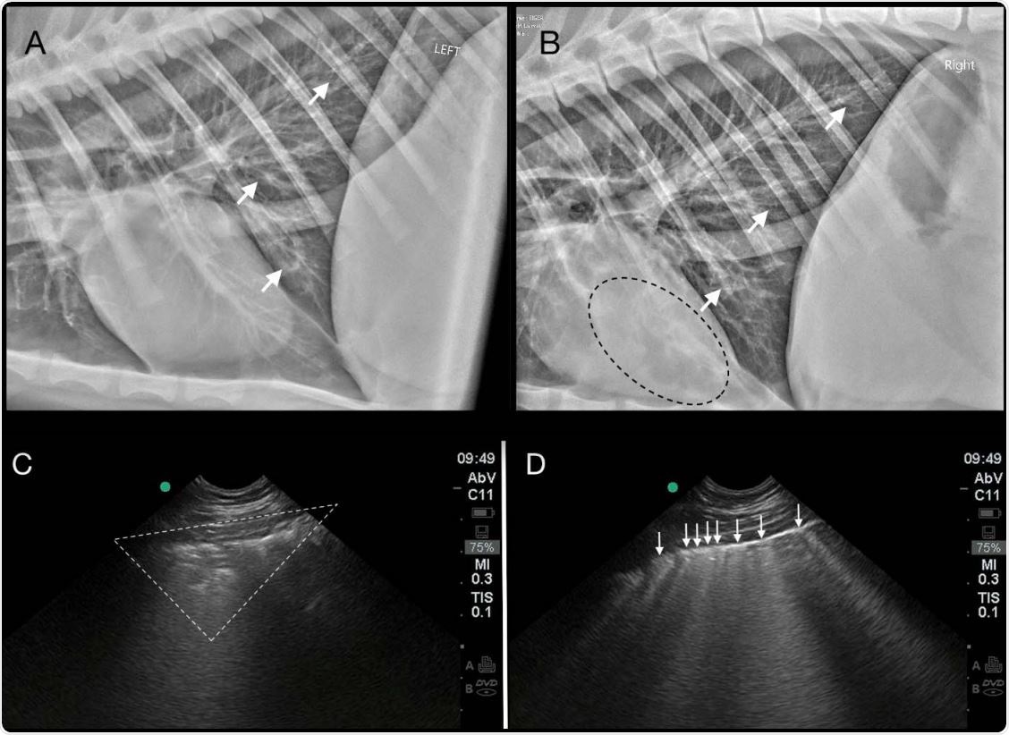 Thoracic imaging abnormalities in the index Tiger (T1) with SARS-CoV-2 infection. A generalized bronchial pattern with peribronchial cuffing and bronchiectasis (white arrows) is present in the caudal lung on left lateral (2A) and right lateral (2B) radiographs. Anesthesiaassociated atelectasis is seen as an alveolar pattern superimposed over the heart (black dotted line) (2B). Pulmonary ultrasonography reveals peripheral consolidation (white dotted triangle) (2C), and coalescence of vertical B-lines (white arrows) (2D) indicating AIS (alveolar-interstitial 580 syndrome).