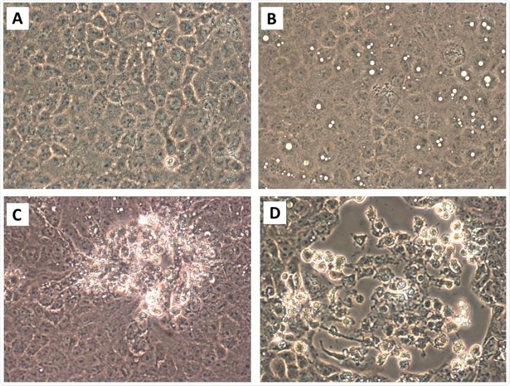 Cytopathic effects in Vero E6 cells inoculated with material collected from the air during air sampling 1-1. [A] Mock-infected Vero E6 cells, 10 days post-inoculation with sterile collection medium. [B]. Large cytoplasmic vacuoles in Vero E6 cells inoculated with collection medium from BioSpot sample 1-1 at 4 dpi. [C] Early focus of infection 7 dpi. [D] Focus of infection 10 dpi. Rounded cells that are detaching, some in clumps, are present. Attached cells remaining in this focus of infection have dark cytoplasms, some have large cytoplasmic inclusion bodies, and some cells are elongated. Original magnifications at 400X.