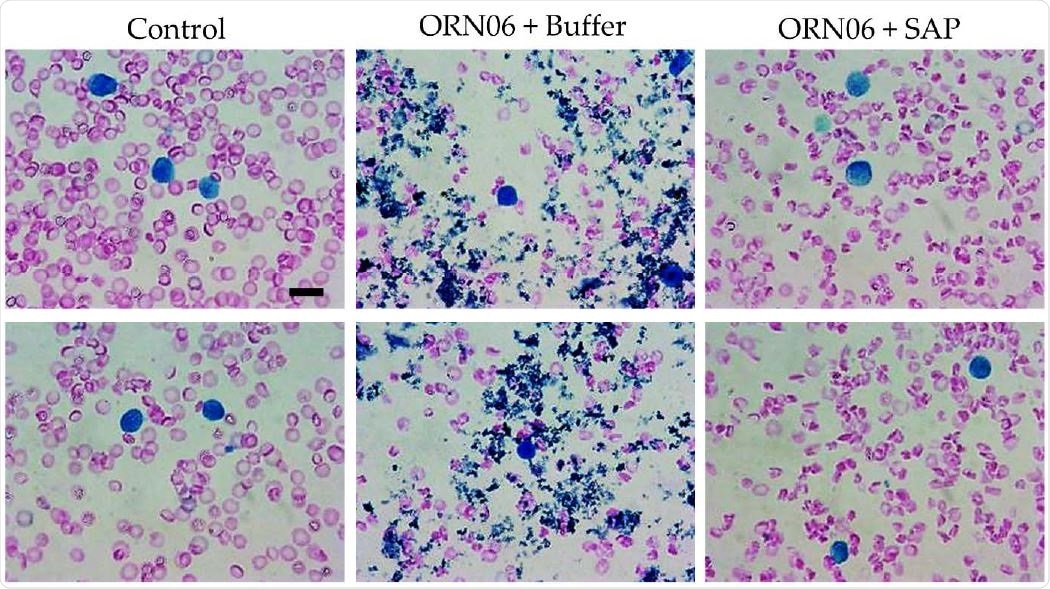 SAP attenuates ORN06-induced clot formation in mouse BAL. Cell spots of BALF at day 3 were stained with Wright-Giemsa stain. The left two images are of BALF cell spots from two different control male mice. The middle two images are of BALF cell spots from two different male mice treated with buffer after ORN06 insult. The right two images are of BALF cell spots from two different male mice treated with SAP after ORN06 insult. Bar is 10 μm.