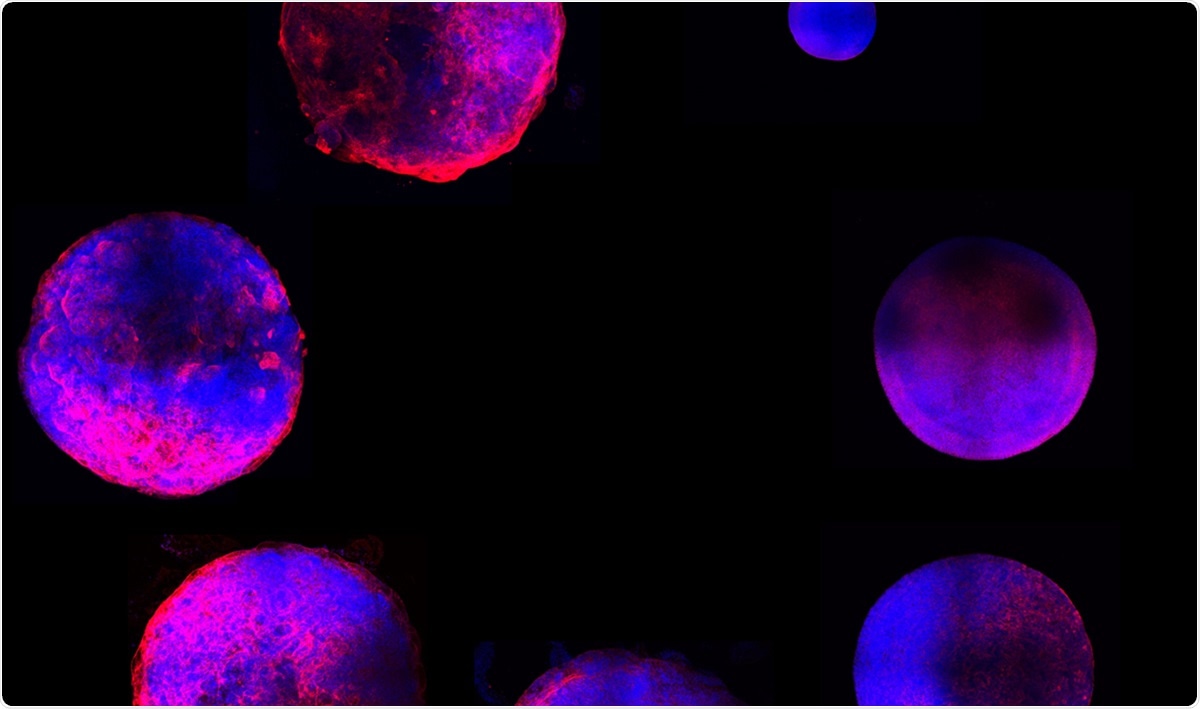 Study: Generation of Heart Organoids Modeling Early Human Cardiac Development Under Defined Conditions. Image Credit: Michigan State University