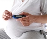 Correlations Between Microbiota and Hyperglycemia in Gestational Diabetes