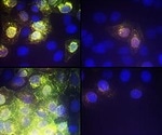 Experimental cancer drug AR-12 inhibits SARS-CoV-2 virus