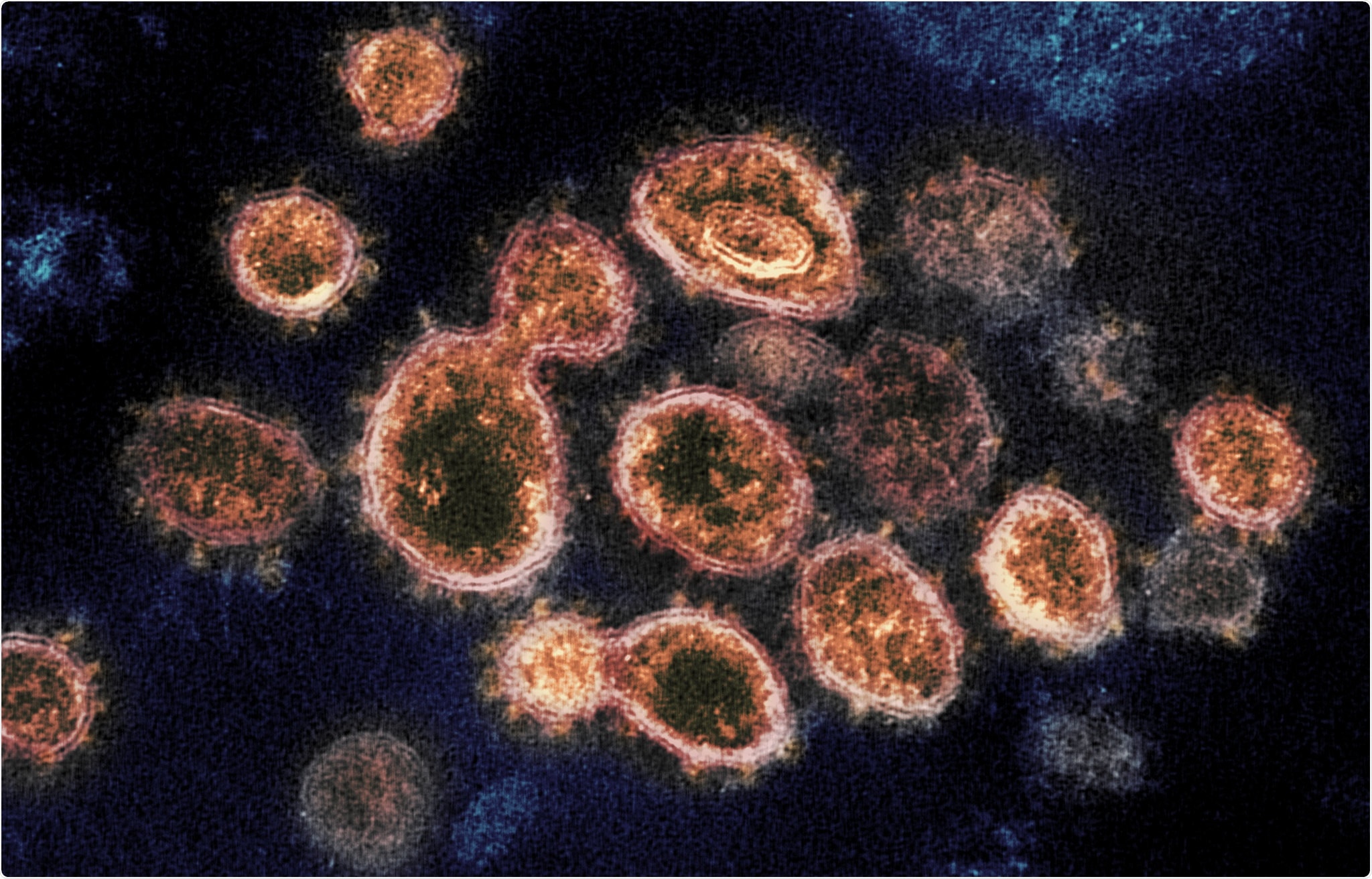 This transmission electron microscope image shows SARS-CoV-2, the virus that causes COVID-19, isolated from a patient in the U.S. Virus particles are shown emerging from the surface of cells cultured in the lab. The spikes on the outer edge of the virus particles give coronaviruses their name, crown-like. Image captured and colorized at NIAID