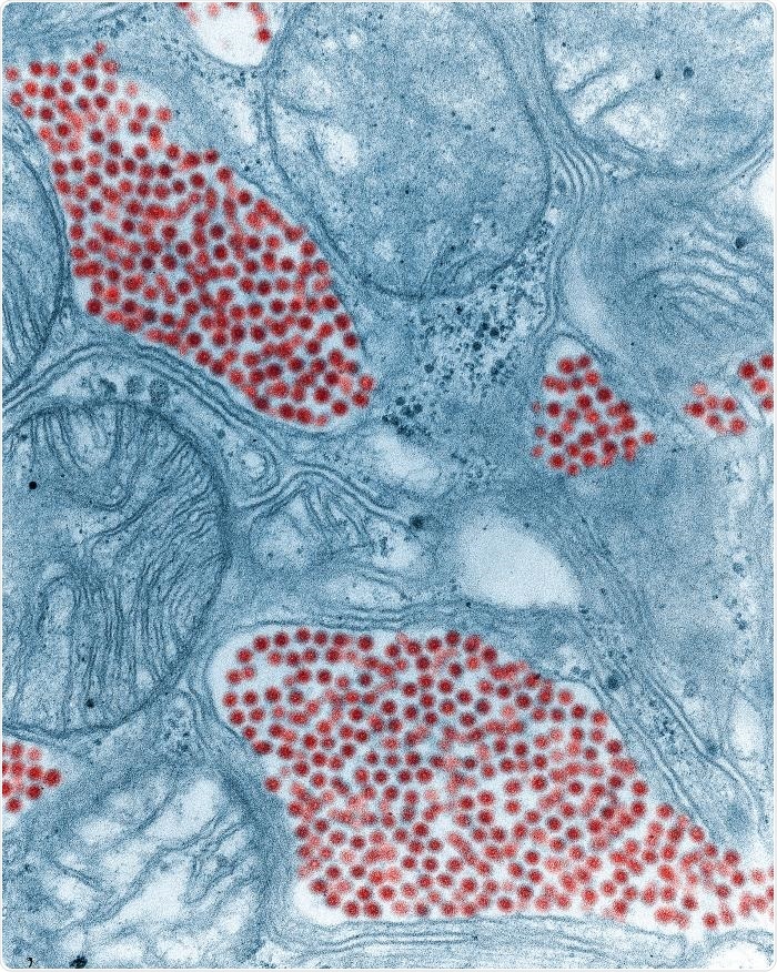 Under a magnification of 83,900X, this digitally colorized transmission electron microscopic (TEM) image depicts a salivary gland tissue section that had been extracted from a mosquito, which was infected by the eastern equine encephalitis (EEE) virus. The viral particles have been colorized red.