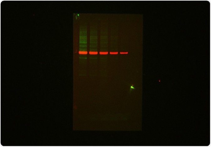 Protein blot stained with Biotium MnS Total Protein Prestain kit CF770T and Primary Rabbit anti-Tubulin/ goat-∝-rabbit IgG – CF 680R and visualized with the ChemStudio using the NIR 660/787 lasers set.