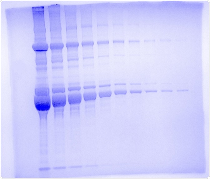 One dimensional SDS polyacrylamide gel electrophoresis using the UVP GelSolo. Mouse serum was run on the gel in 1:2 dilution series from 20 μg to 39 ng on a 4 - 12 % Bolt Bis-Tris Plus Gel for 32 minutes at 200 V. Gel was stained with SimplyBlue Safe Stain and imaged on the UVP GelSolo with 302 nm UV light and a white light converter plate with an exposure time of 22 s. Image was pseudocolored with Coomassie blue