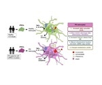 Study links brain astrocyte dysfunction to Parkinson’s disease pathology