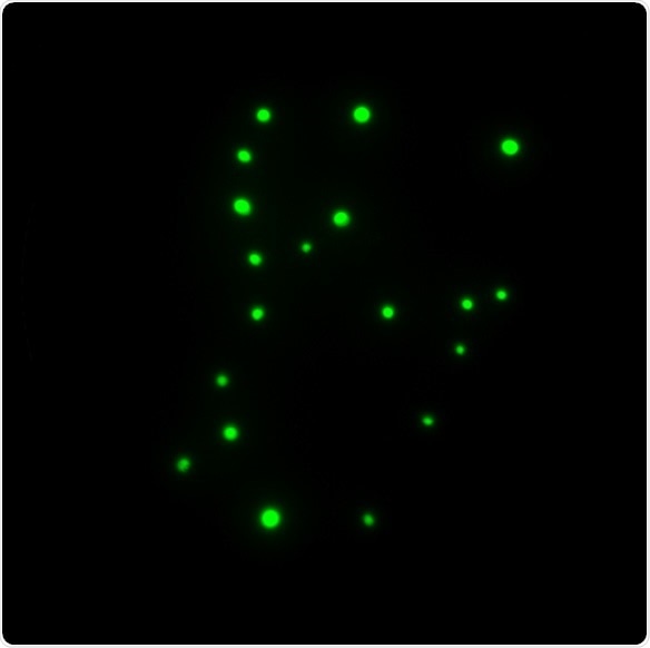 a) Green fluorescent colonies