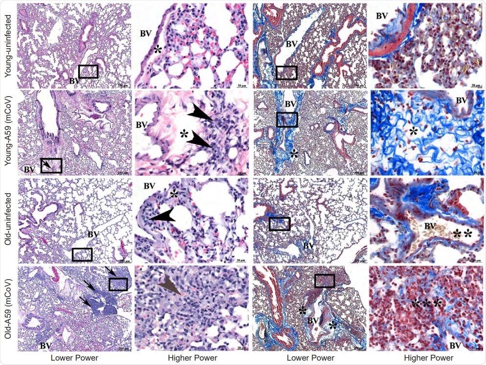 Inflammatory response in young and old mice infected with A59 (mCoV)