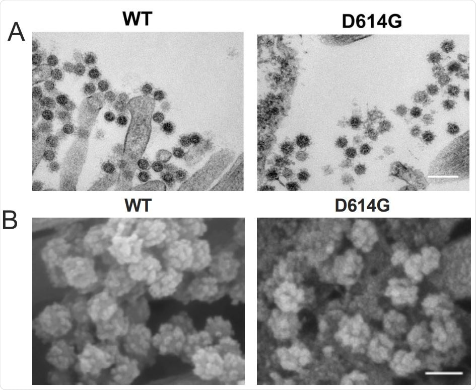 D614G substitution does not alter SARS-CoV-2 virion morphology and S protein cleavage pattern but change viral sensitivity to neutralizing antibodies. A. Transmission electron microscopy image of WT and D614G virions on airway epithelial cell surface, scale bar: 200 nm. B. Scanning electron microscopy images of WT and D614G virions on airway epithelial cell surface, scale bar: 100 nm.