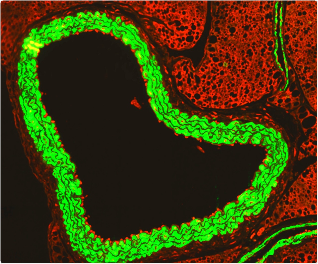 An immunofluorescence microscopy image shows how activated immune cells (red) ‘stick’ to the inside of the aorta (green) during flu infection in pregnancy.