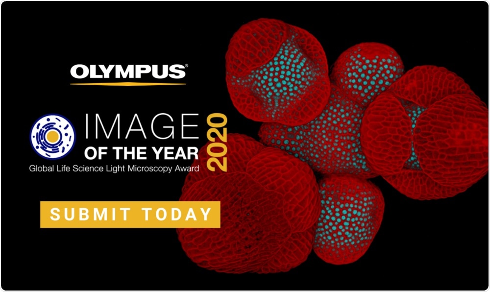 The art of science: Olympus launches second global image of the year award