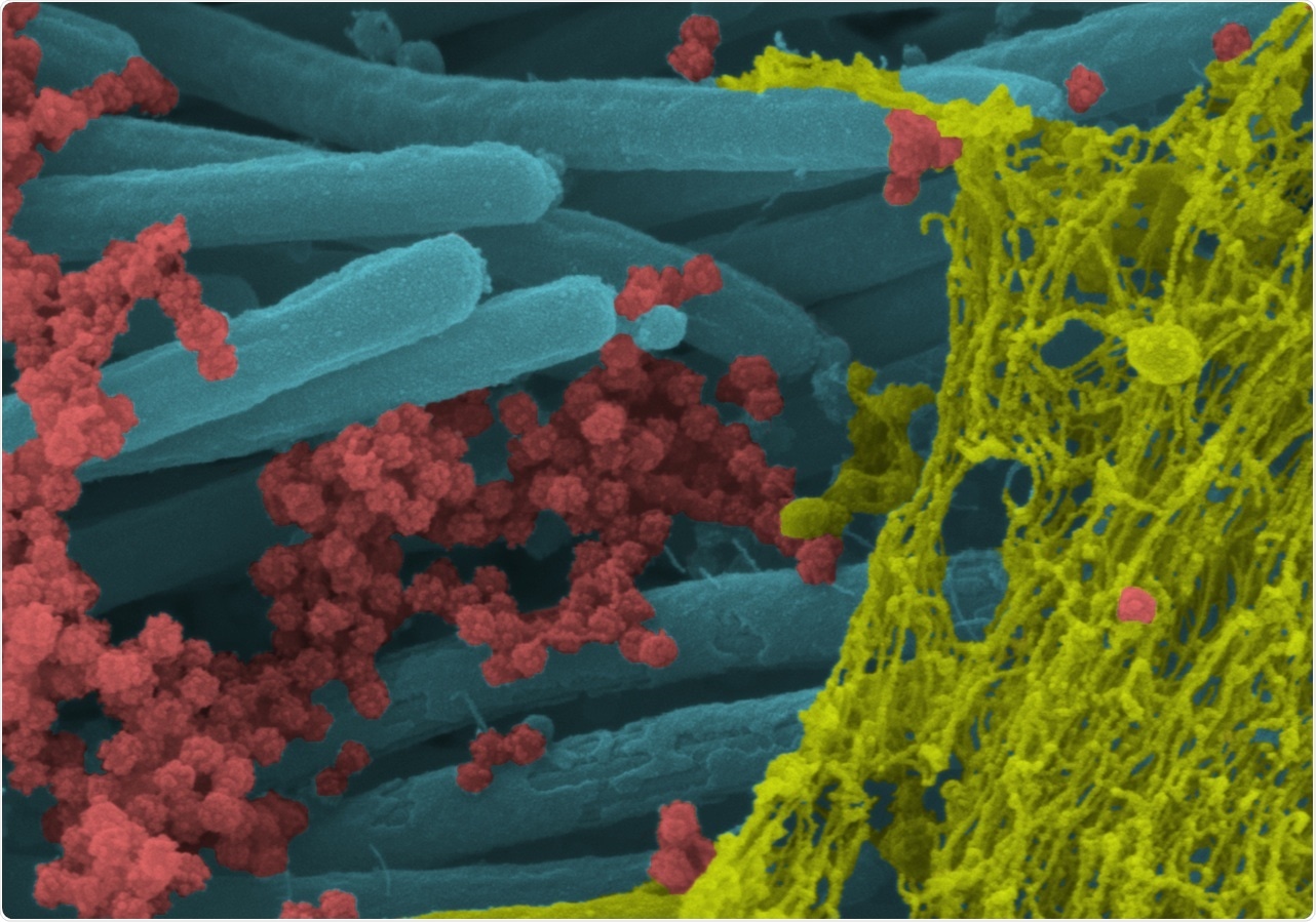 A higher power magnification image shows the structure and density of SARS-CoV-2 virions (red) produced by human airway epithelia. (Ehre Lab, UNC School of Medicine)