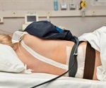 Epidural for Labor Pain