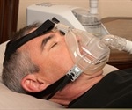 Sleep apnea increases risk of severe COVID 19
