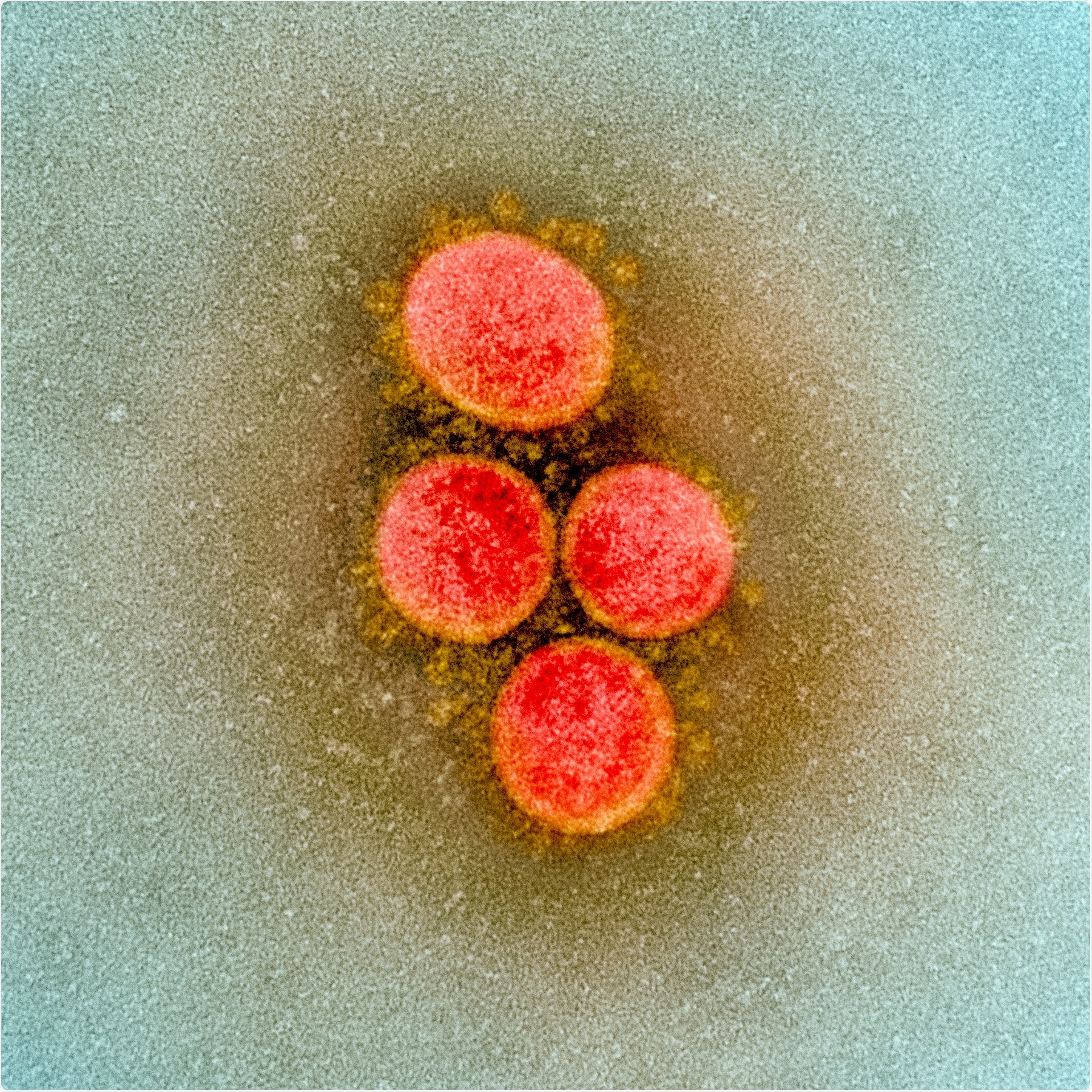 Studio: Emergenza delle mutazioni multiple SARS-CoV-2 in un host immunocompromised. Credito di immagine: NIAID