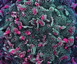 A high-temperature tolerant SARS-CoV-2 derived immunogen as a potential vaccine candidate
