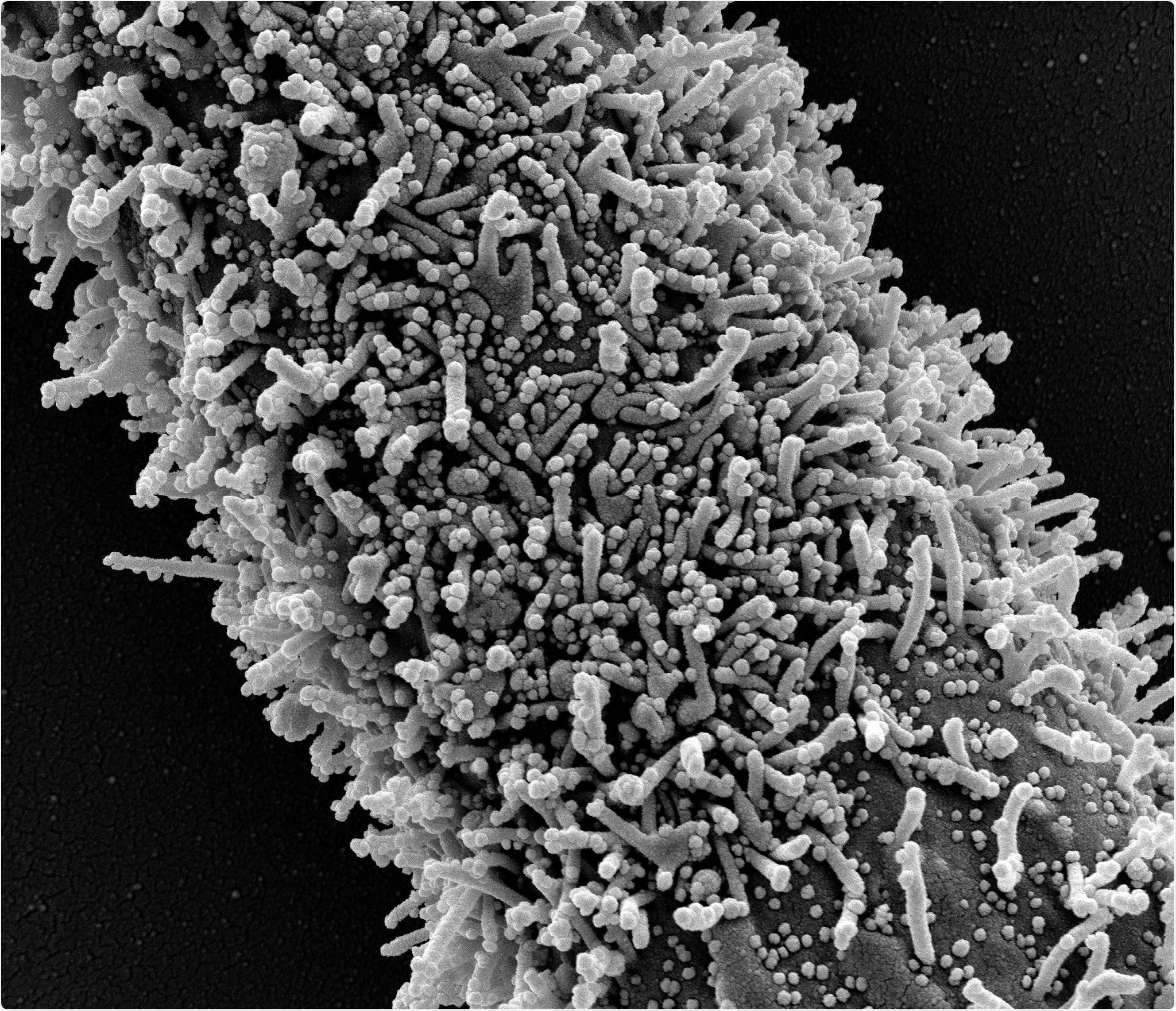 A single elongated CCL-81 cell heavily infected with SARS-CoV-2 virus particles. The small spherical structures in the image are SARS-CoV-2 virus particles. The rod-shaped protrusions from the cells are cell projections or pseudopodium. Image captured at the NIAID Integrated Research Facility (IRF) in Fort Detrick, Maryland. Credit: NIAID